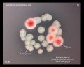 escherichia coli